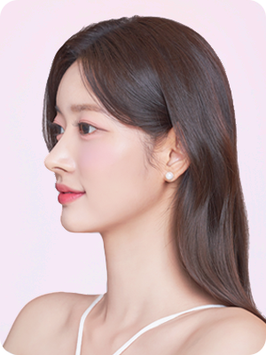 코성형